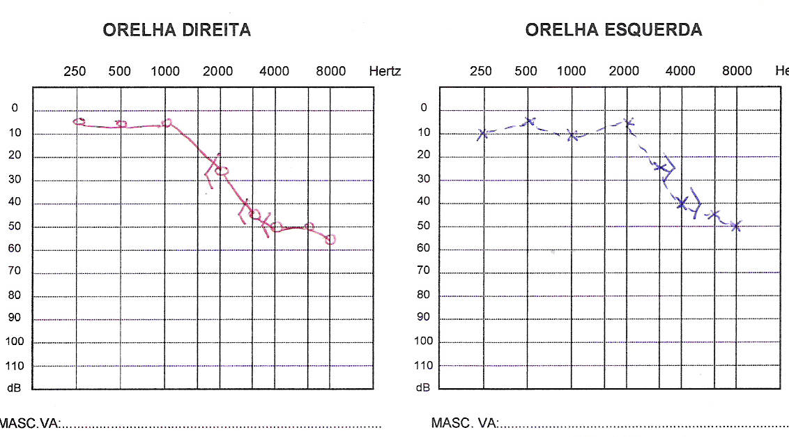 1 AUDIOMETRIA TONAL LIMIAR E VOCAL Clínica Orel