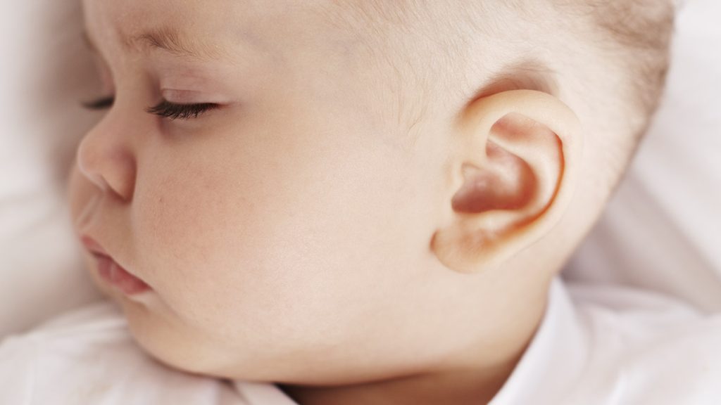 Tratamento de Deformidades Auriculares em Recém Nascidos