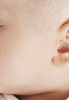 Como saber se o meu filho possui orelha de abano?