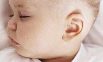 Como saber se o meu filho possui orelha de abano?