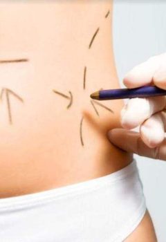 Abdominoplastia: Riscos x Benefícios! Vale a pena?