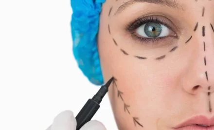Cirurgia plástica no rosto, as mais famosas e efetivas no Brasil!