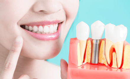 Tipos de prótese dentária