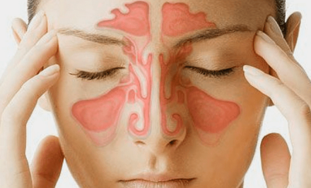 Sinusite pode causar dor de cabeça?