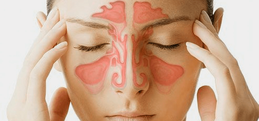 Sinusite pode causar dor de cabeça?