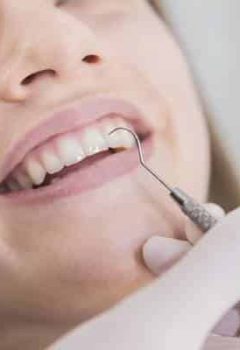 Como evitar o tártaro ou cálculo dental?
