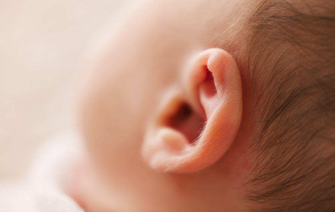 Deformidade de orelhas em recém-nascidos!