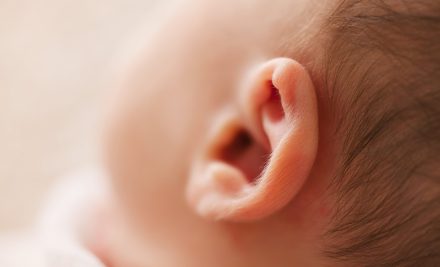 Deformidade de orelhas em recém-nascidos!
