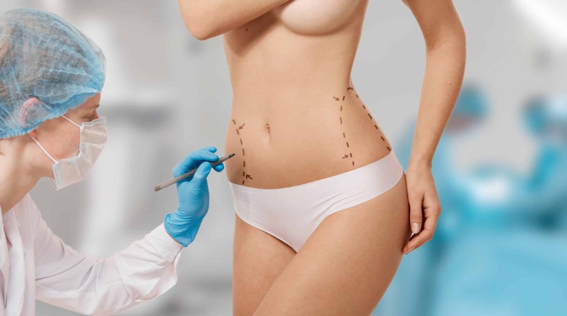 Lipoaspiração a laser: benefícios e limitações