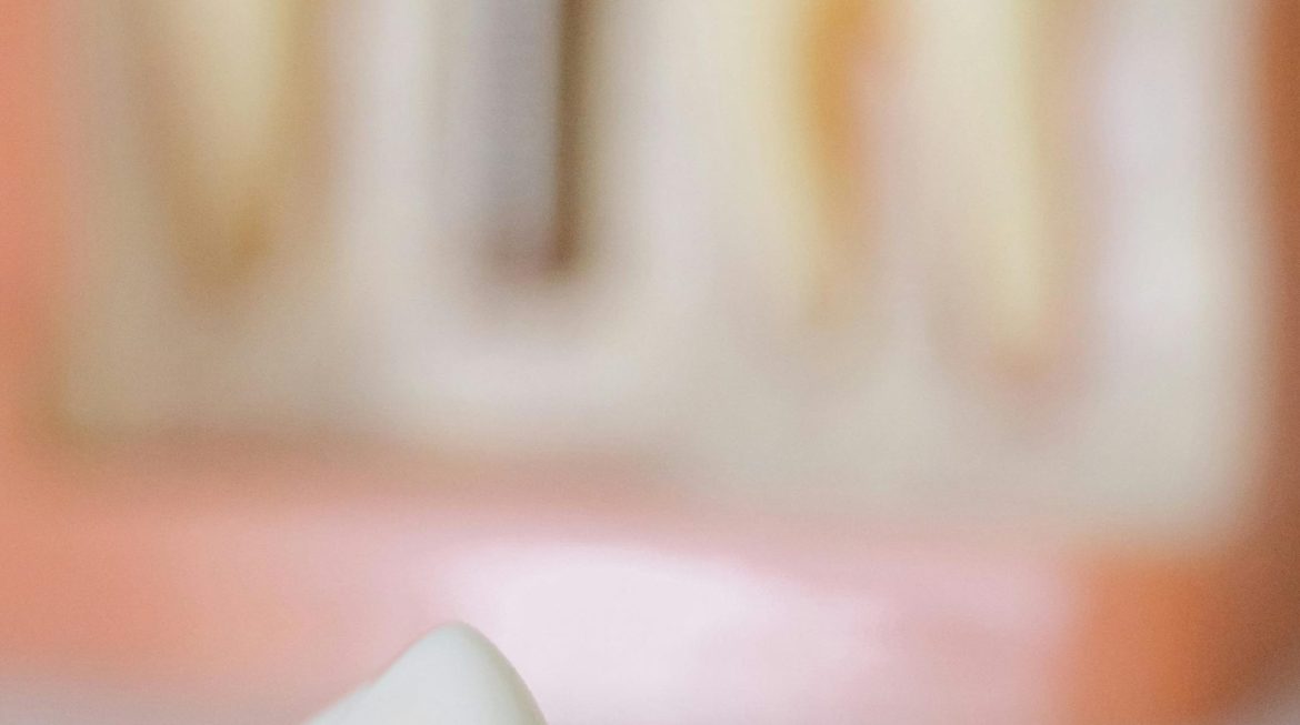 Inovações em próteses e implantes dentários