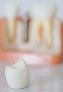 Inovações em próteses e implantes dentários