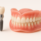 Inovações em próteses e implantes dentários